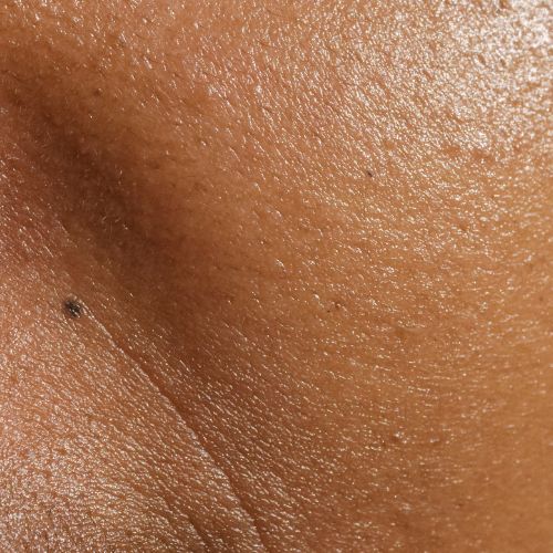 Finelines & Wrinkles
